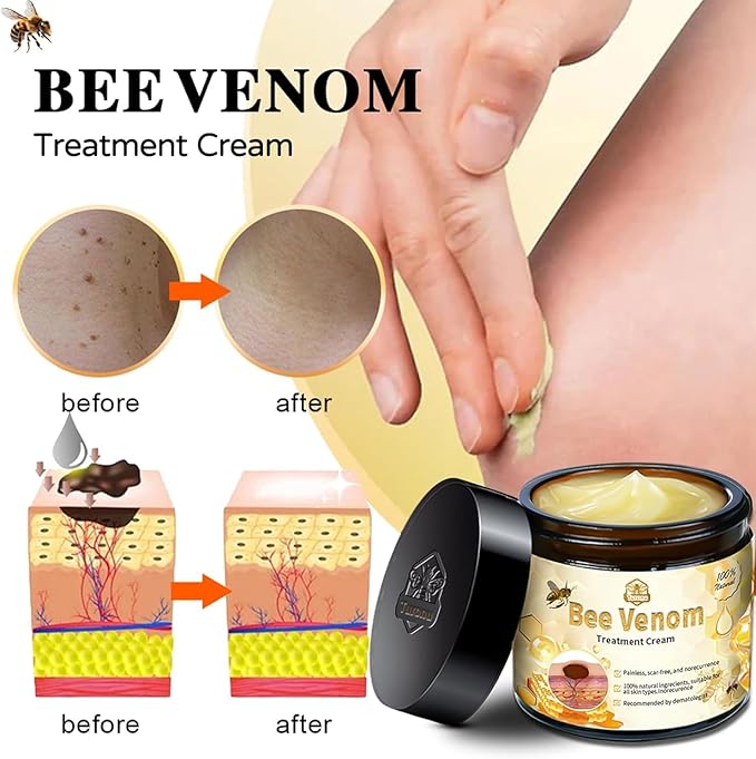 🐝✨ BeeFlex™ - Bee-Venom Pain-Relief Bone Healing Cream (Buy 1 Get 1 Free!)