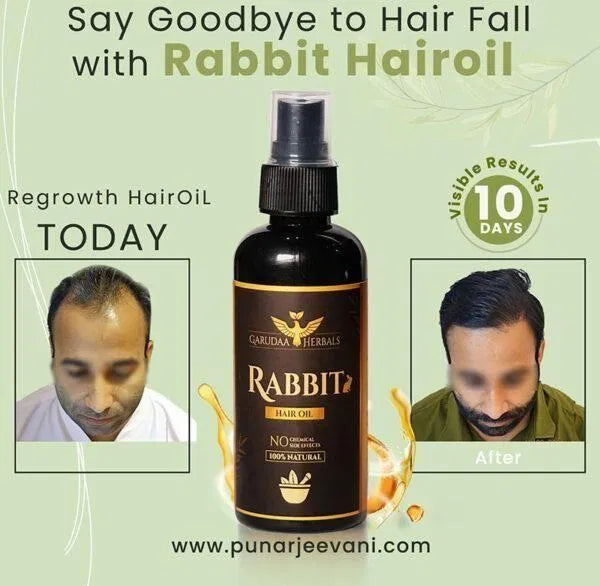 Rabbit Hair Oil (30 ml) Pack of 2
